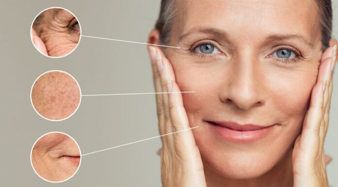 Review kem chống nắng quang phổ rộng là gì? Cách nhận biết kcn phổ rộng Da bị lão hóa