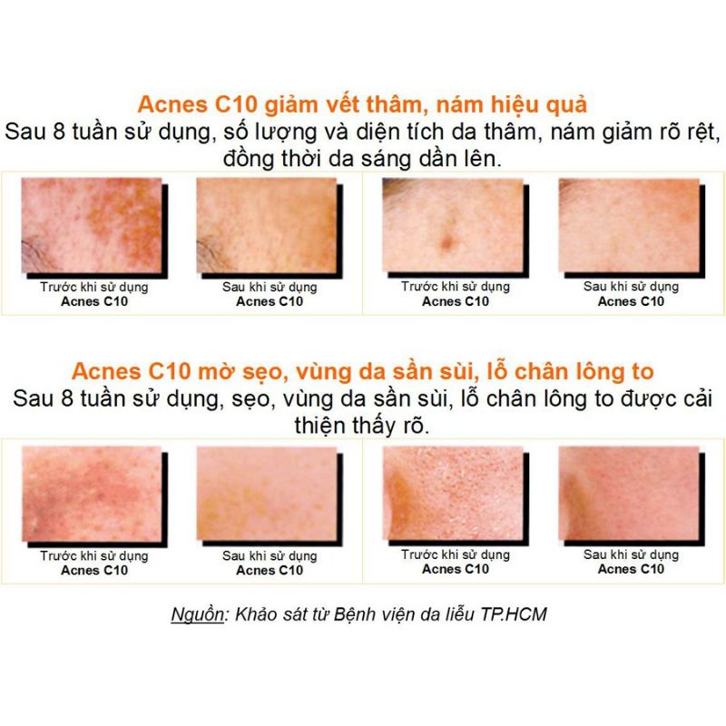 serum acnes c10