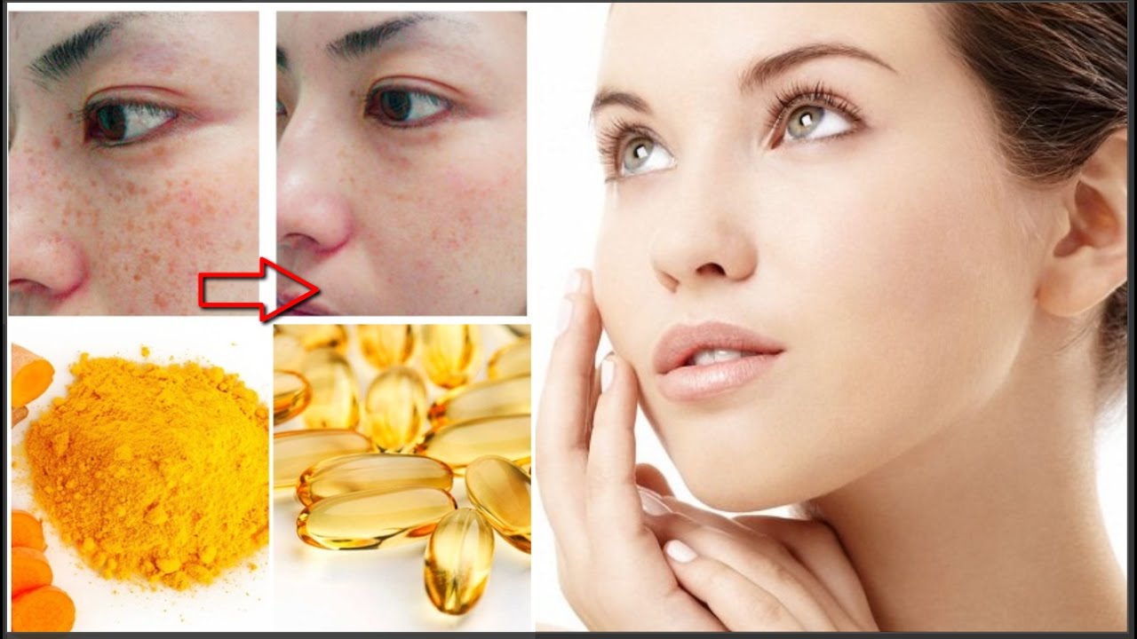 Mặt nạ vitamin E và nghệ có thể sử dụng được cho tất cả mọi loại da
